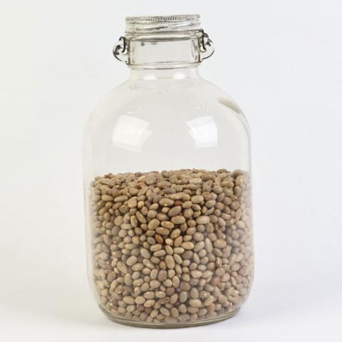 Equipo de registro MRM